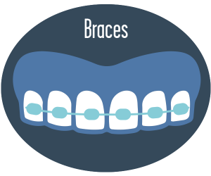OrthoGuide braces