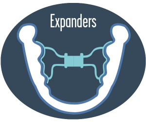 OrthoGuide expander